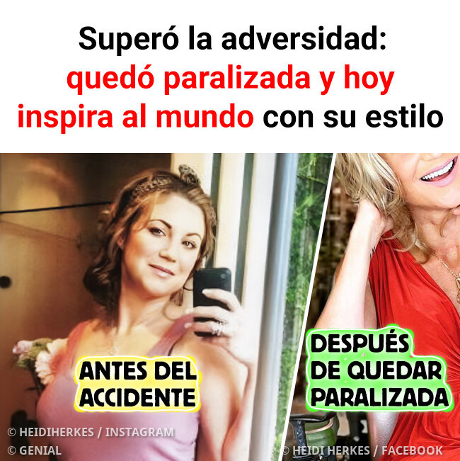 Genial - La vida la desafió, pero ella eligió seguir adelante. Conoce ...