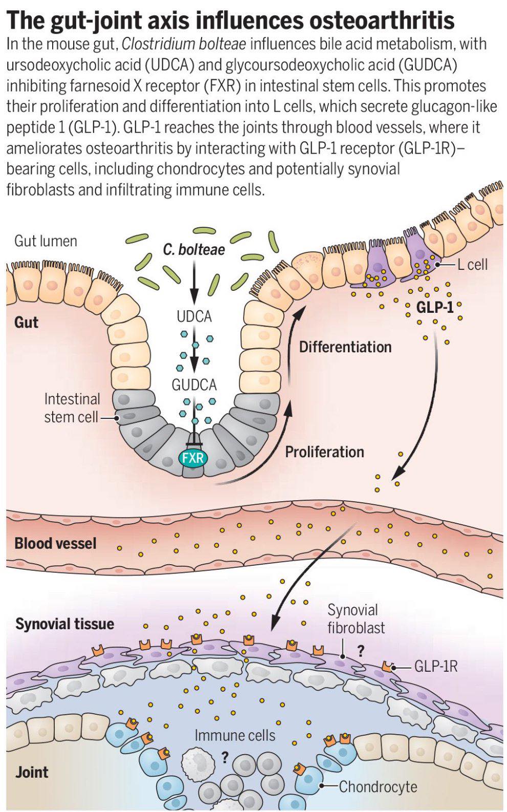 Do biologics and GLP-1 work together for arthritis pain?