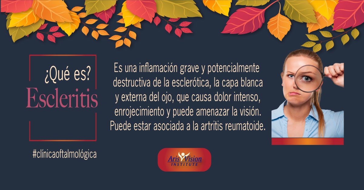 #enfermedadesdelosojos 👀 👉La escleritis... - Aris Vision CDMX | Facebook