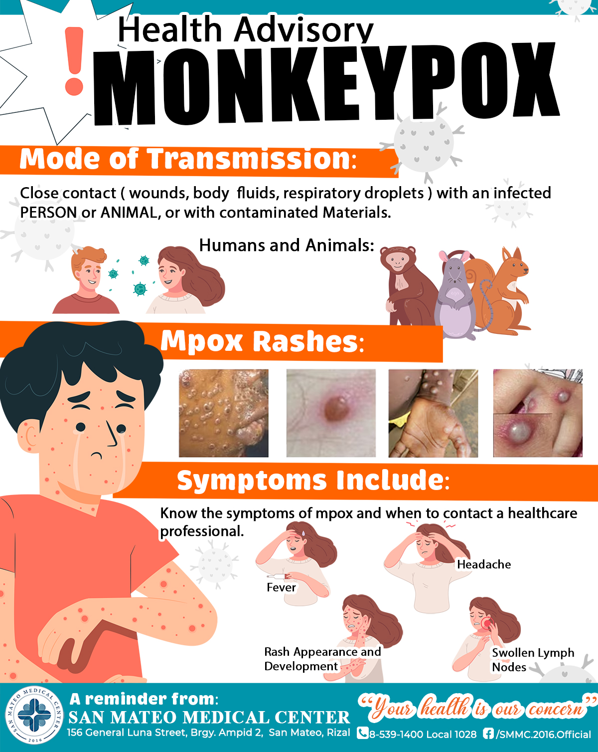 Health Advisory! Monkeypox... - San Mateo Medical Center | Facebook