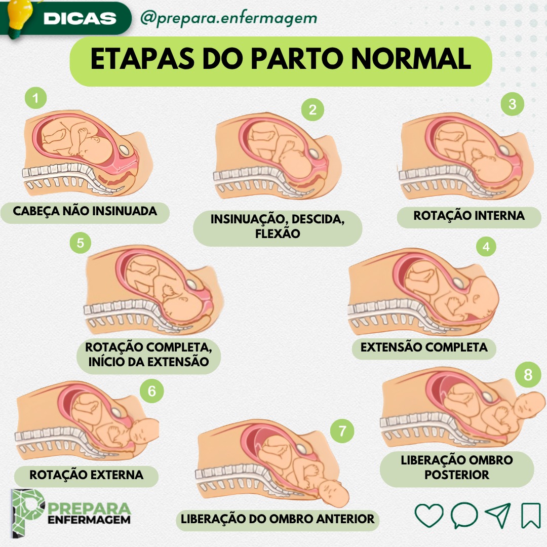 👶 Etapas do Parto Normal: Mecanismo... - Prepara Enfermagem | Facebook
