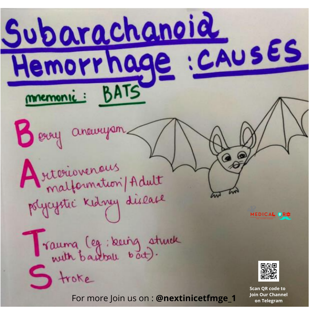 Medical Bro - Mnemonics : Subarachanoid Hemorrhage #mnemonics # ...