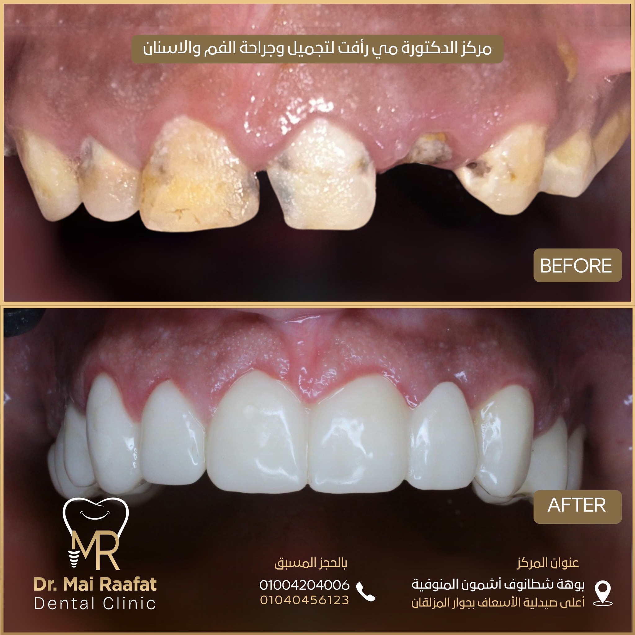 Dr. Mai Rafaat Dental Clinic | Ashmun