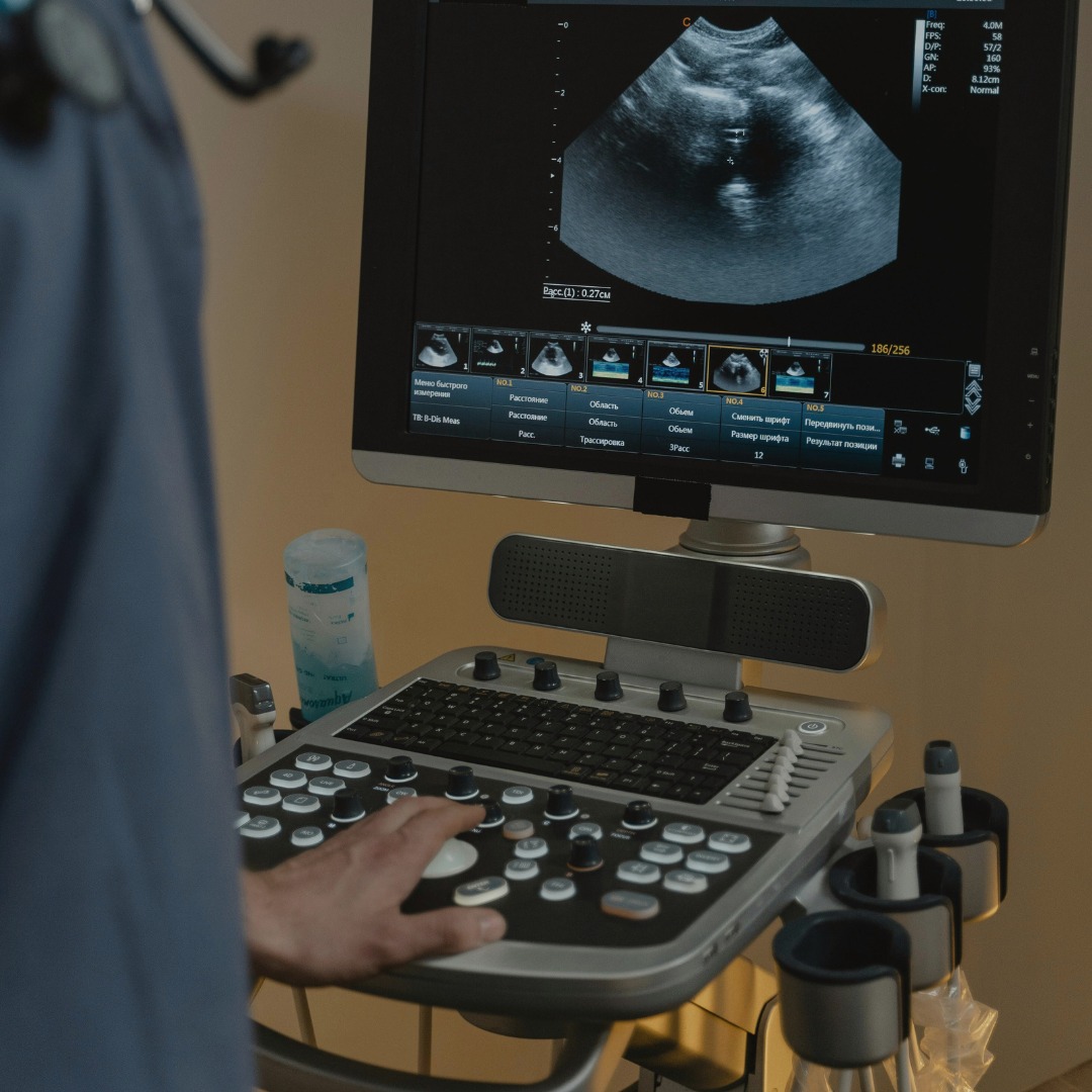 Fertility - What is a Transvaginal Ultrasound? At FSMG, transvaginal ...