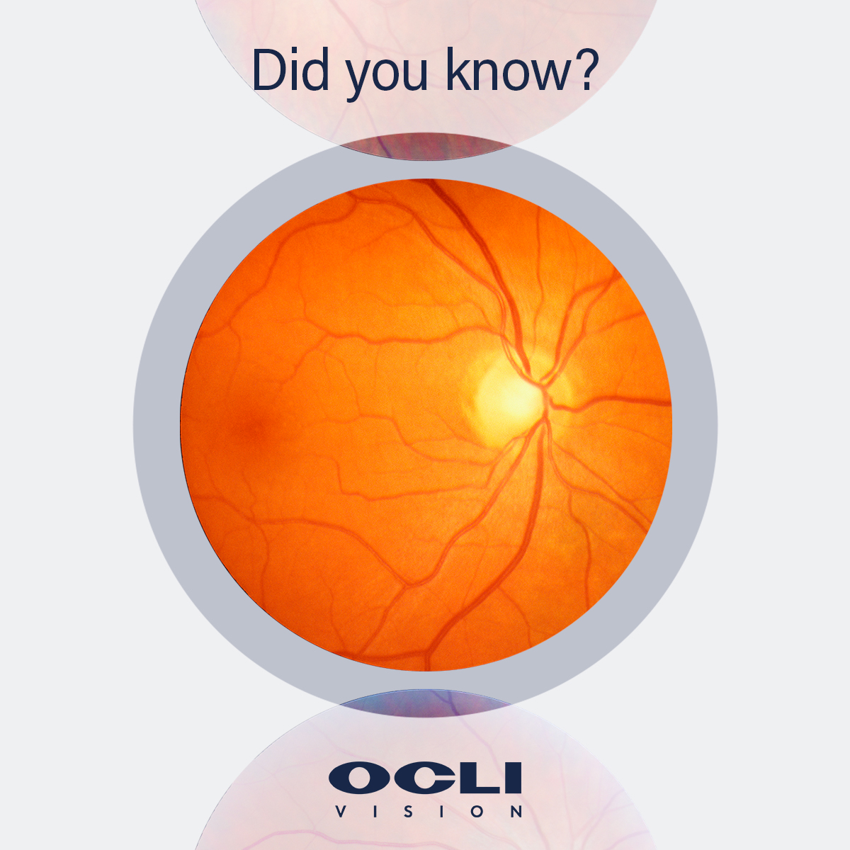 OCLI Vision