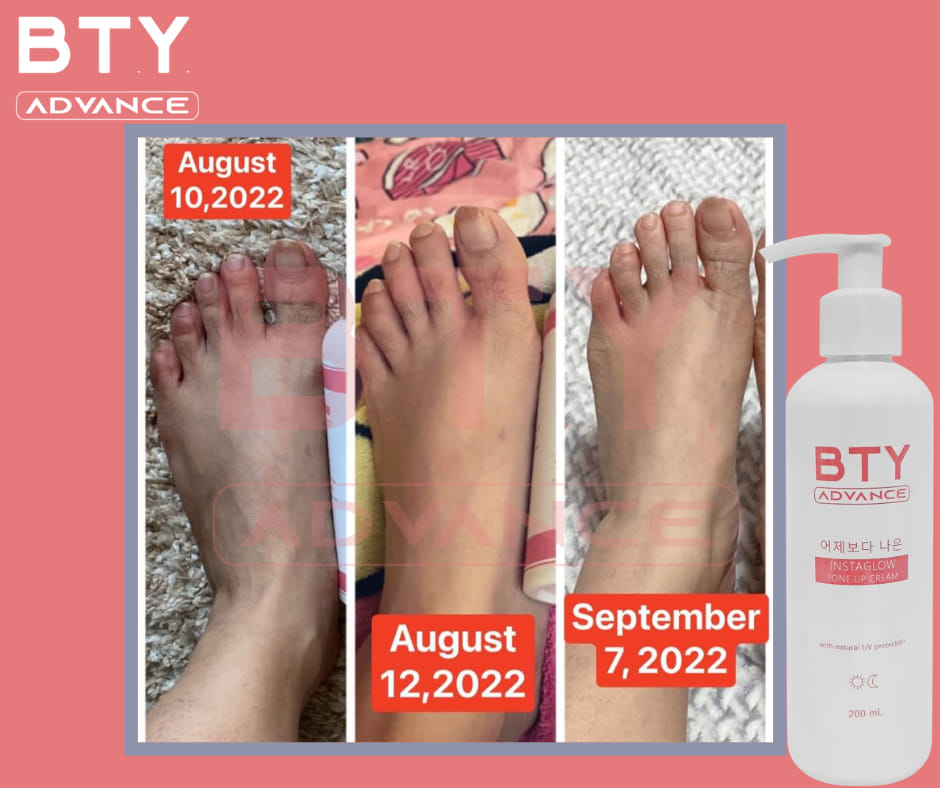 BTY Alexa Skincare - TOTOO TALAGA ITO 😱 EFFECTIVE TALAGA PANG REMOVE ...