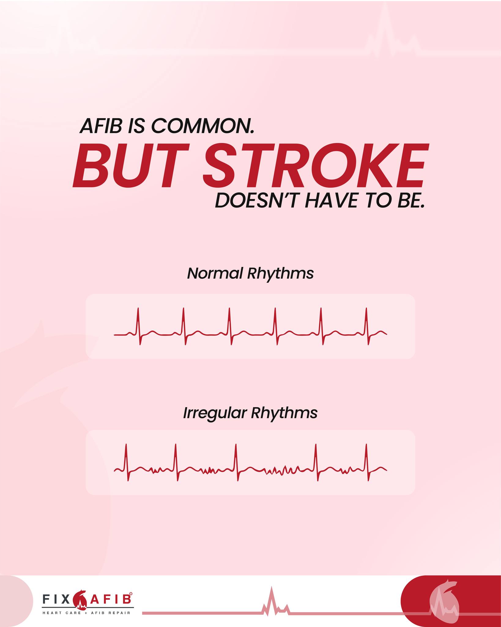 Fix AFib - Atrial fibrillation is more than a fast... | Facebook