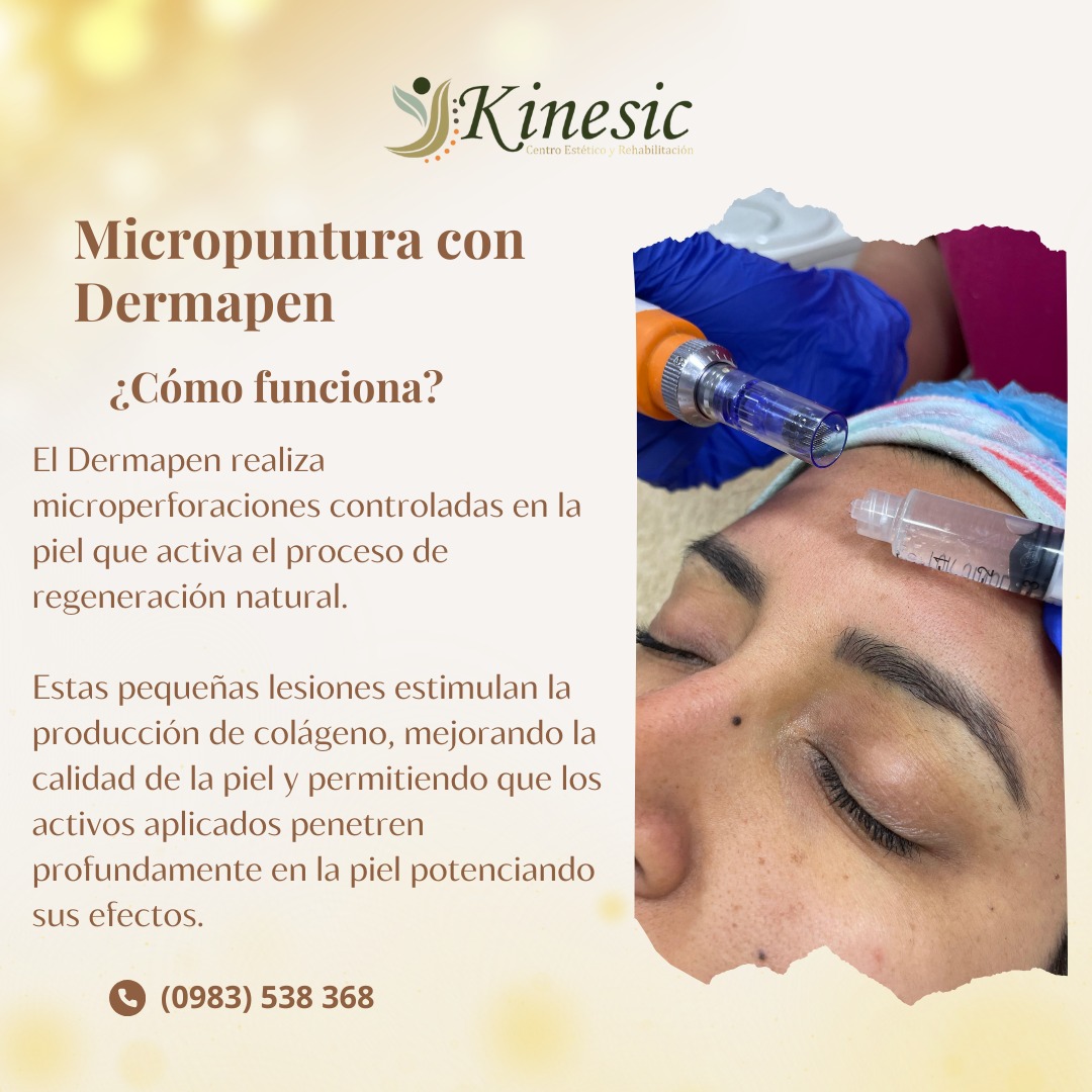 Kinesic - 🌟 ¡Renueva tu piel con Dermapen! 🌟 La... | Facebook
