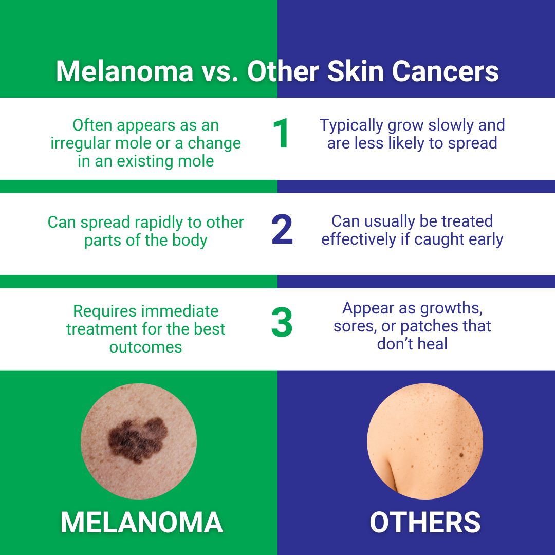 🩺 Did you know? Melanoma is the... - The Skin Cancer Doctor | Facebook