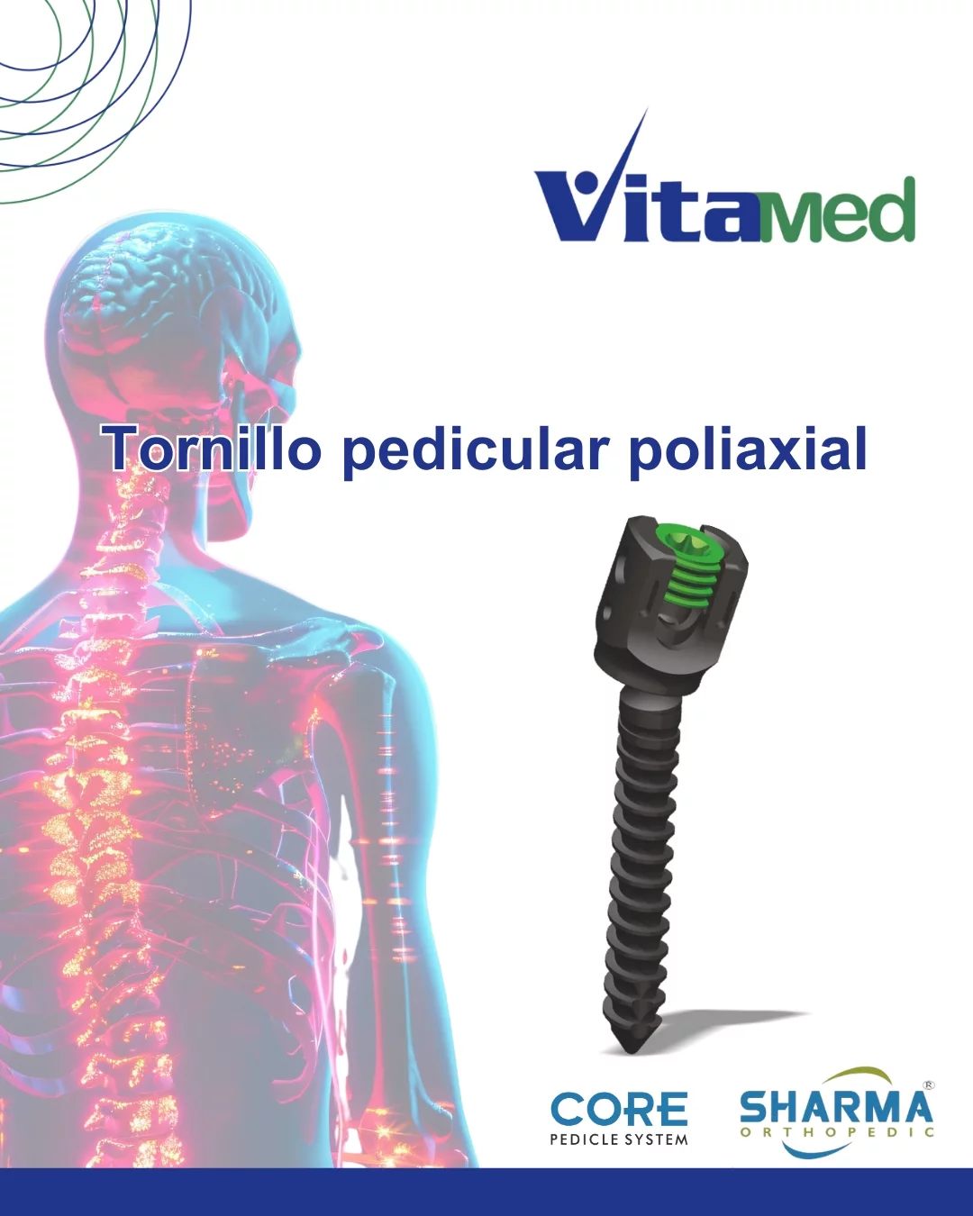 Vitamed - El tornillo pedicular poliaxial es un elemento clave en la ...