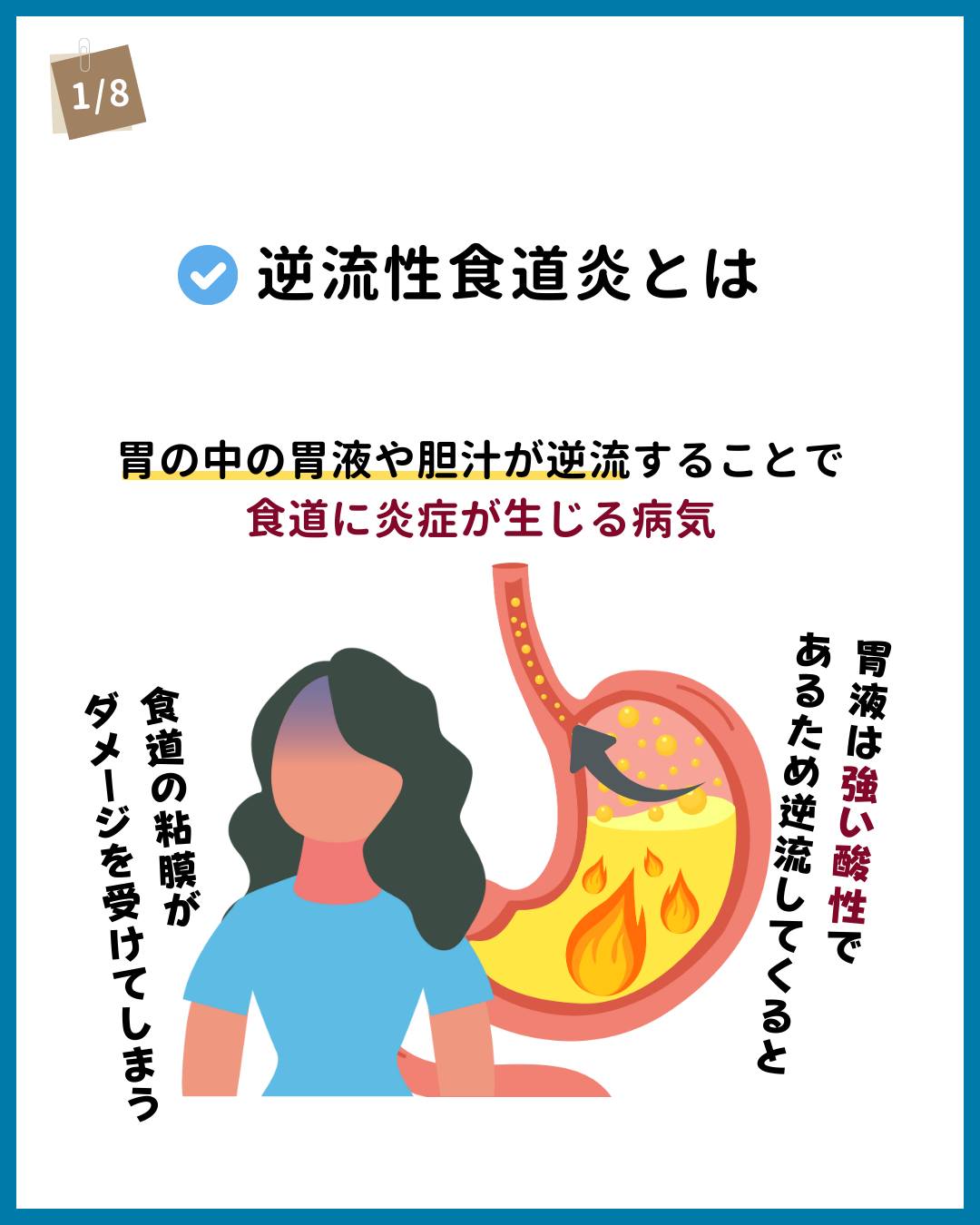 逆流性食道炎 やってはいけない こと
