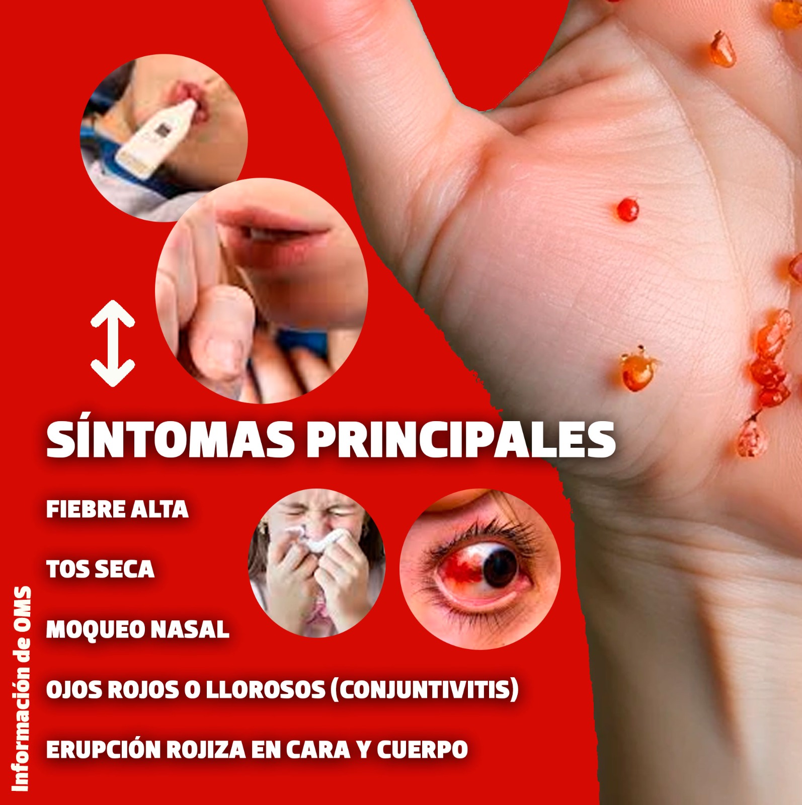 😷 ¿Qué es el Sarampión? ¿Hay un... - La Voz de la Frontera | Facebook