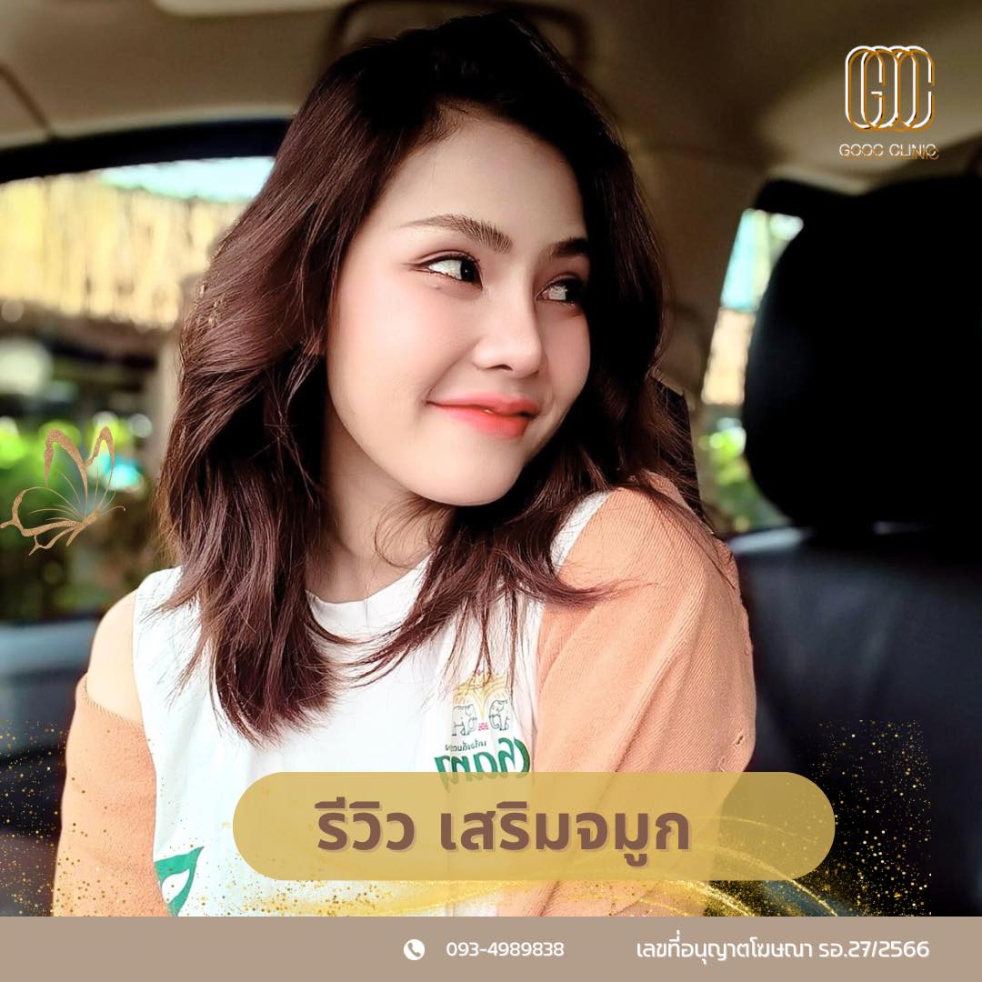 รีวิวเสริมจมูก ⭕️สวยละมุน เป็นธรรมชาติไว้ใจ GOOC CLINIC📌 จะดีกว่าไหมถ้า ...