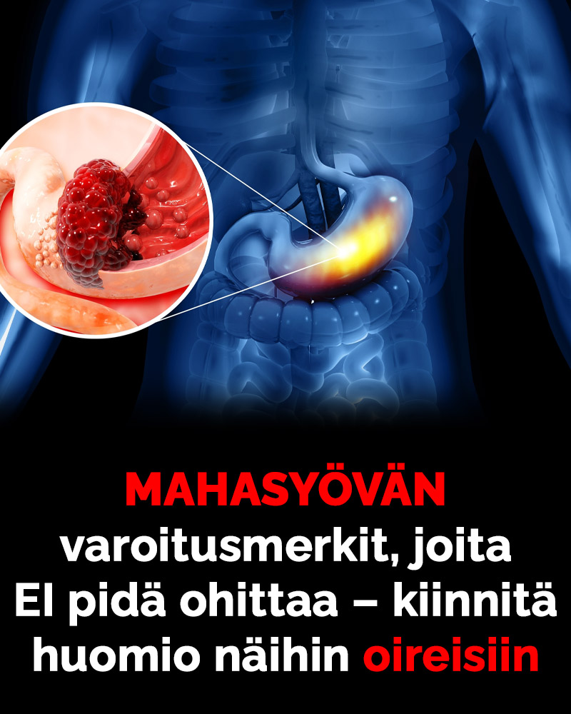 newsner-mahasy-p-on-salakavala-sairaus-jota-voi-olla-vaikea