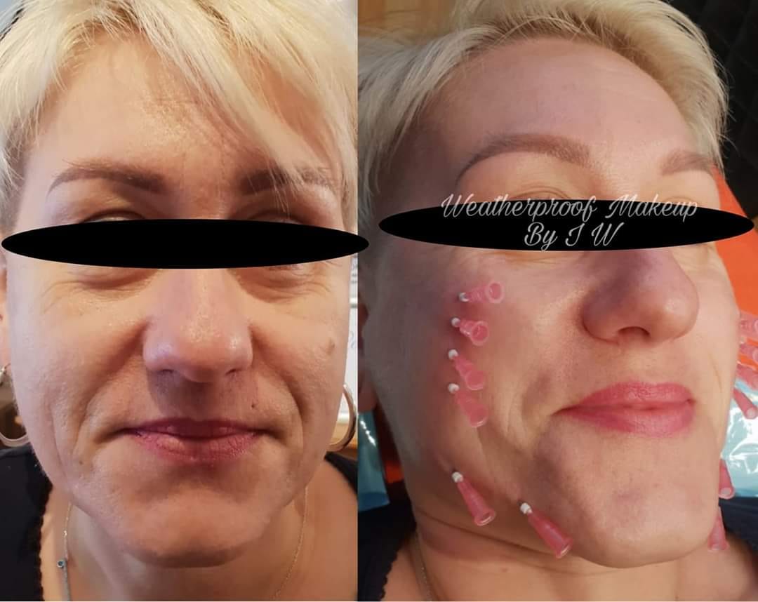 Lifting threads These recently... - Weatherproof spmu makeup