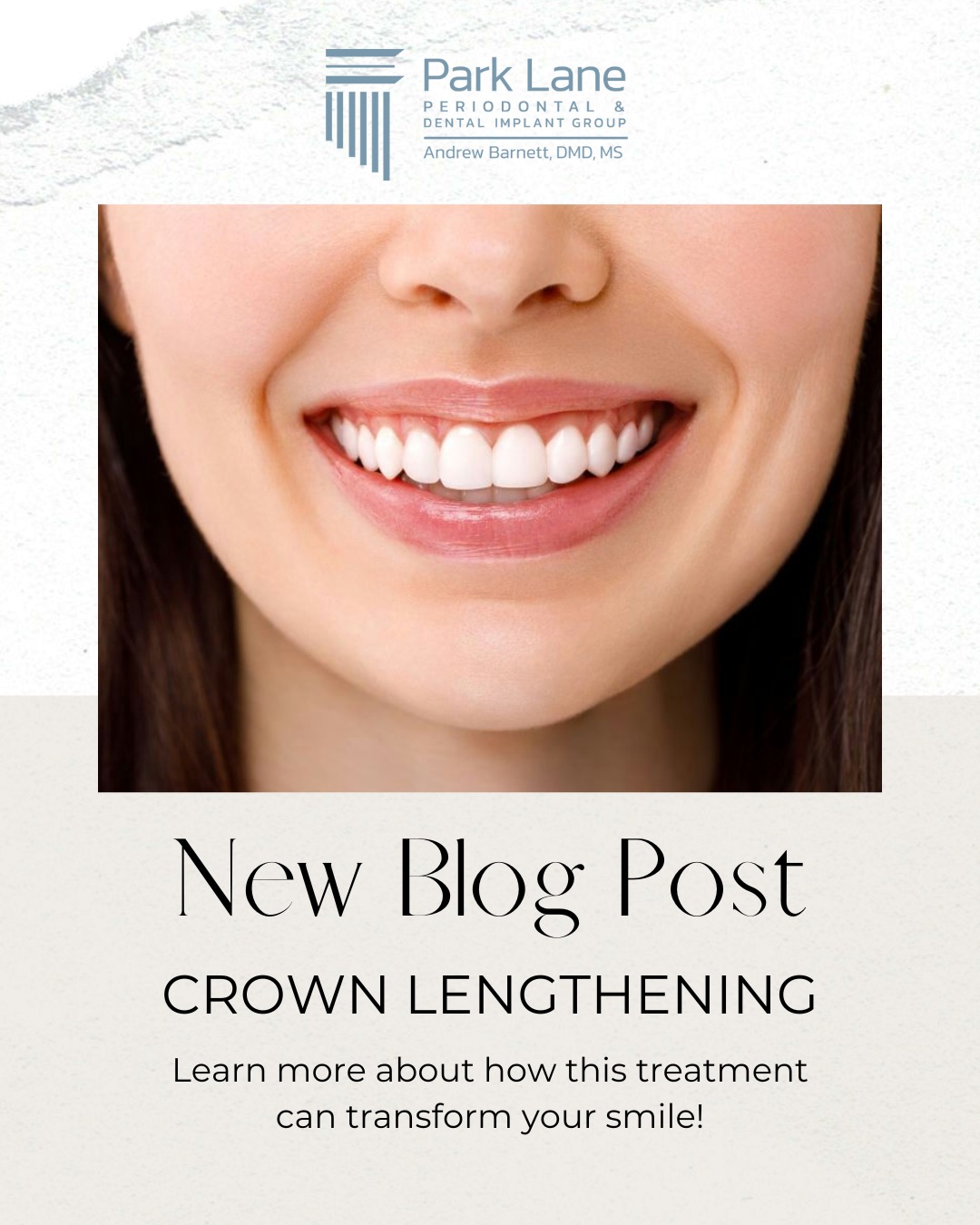 Park Lane Periodontal and Dental Implant Group | Dallas TX