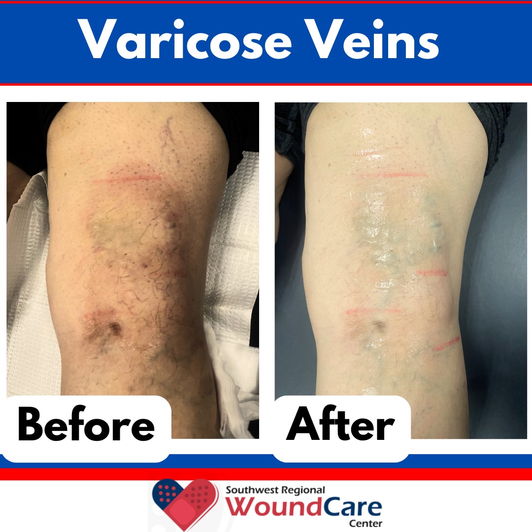 Southwest Regional Wound Care Center | Lubbock TX