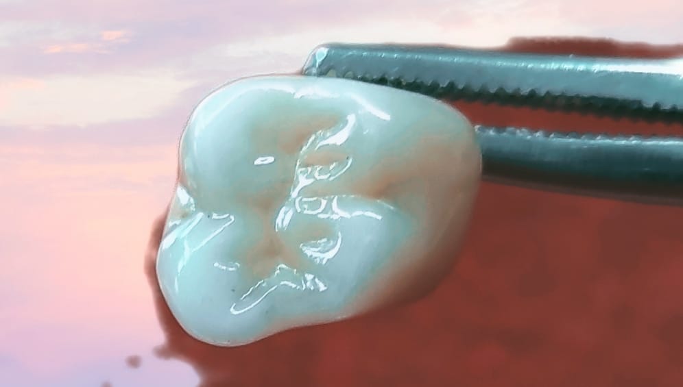 مختبر الإتقان دنت لصناعة الأسنان Alatqan Dental Lab