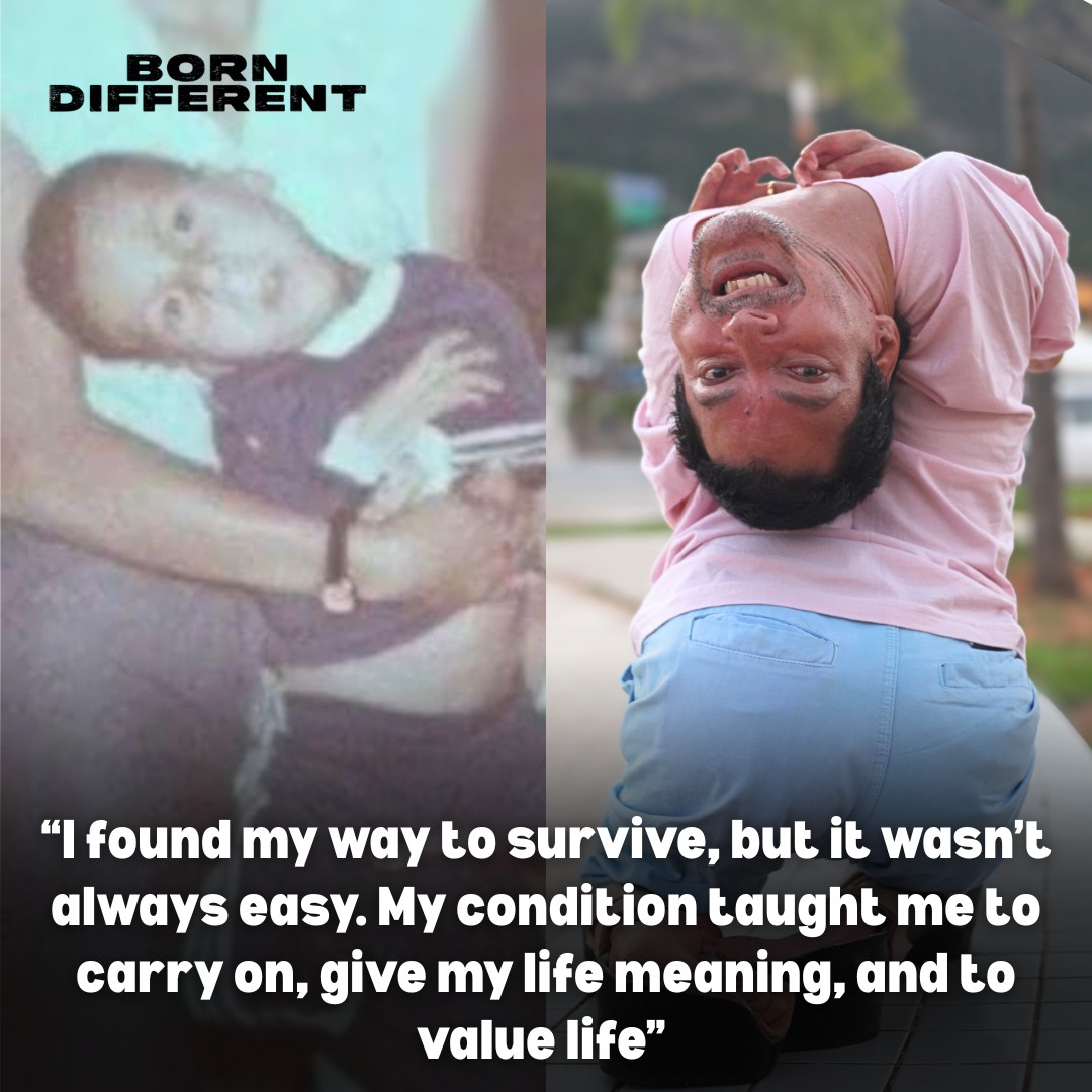 Born - Claudio Vieira de Oliveira literally sees the world upside down ...