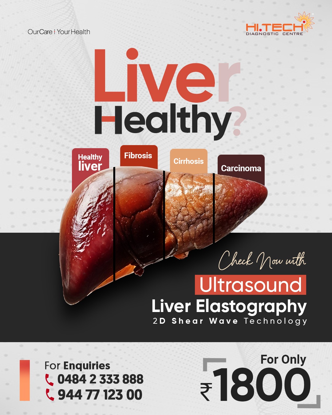 Early-stage liver conditions... - HITECH DIAGNOSTIC CENTRE | Facebook