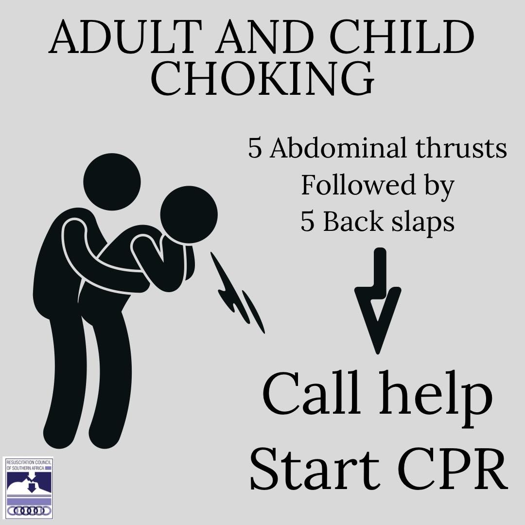 Resuscitation - Choking can happen anytime and anywhere, with anyone ...