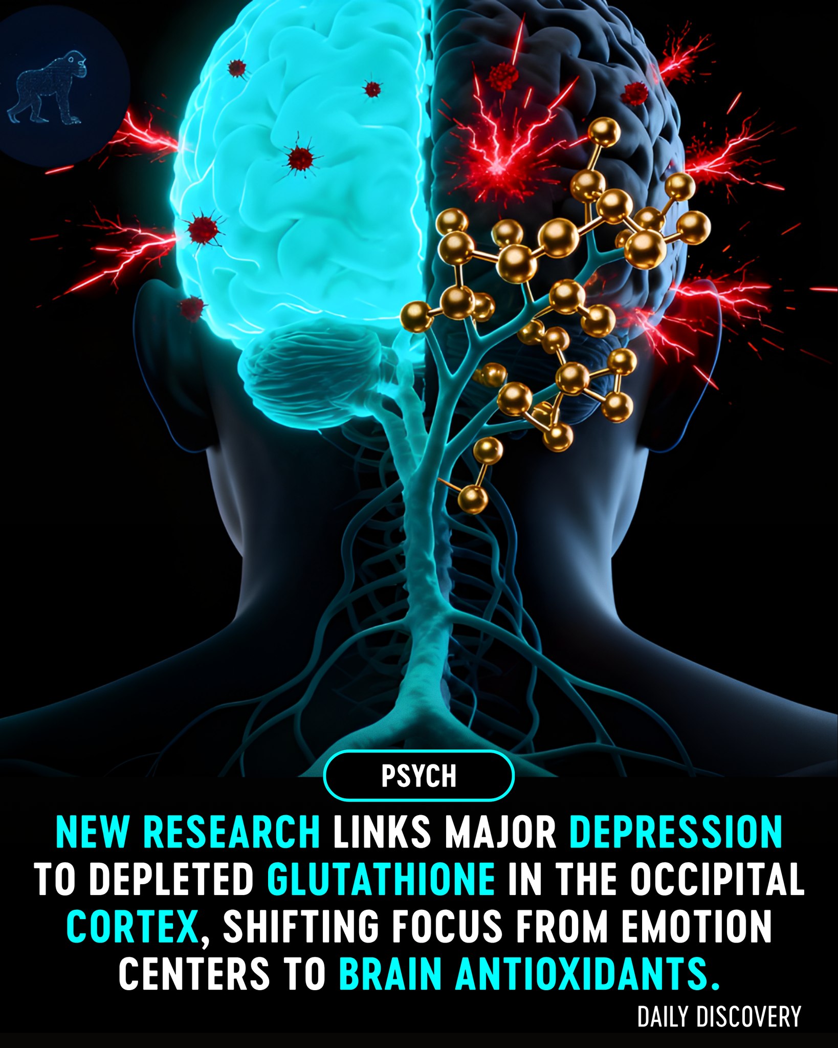 glutathione deficiency depression Could be (also) caused by oxidative stress? 🤔 A team of researchers conducted a meta-analysis to explore this. They found that people with depression had lower levels of glutathione—a key antioxidant—in Shade:Bellini Cagrilintide Acetate 10mg by SUPPOSITORY