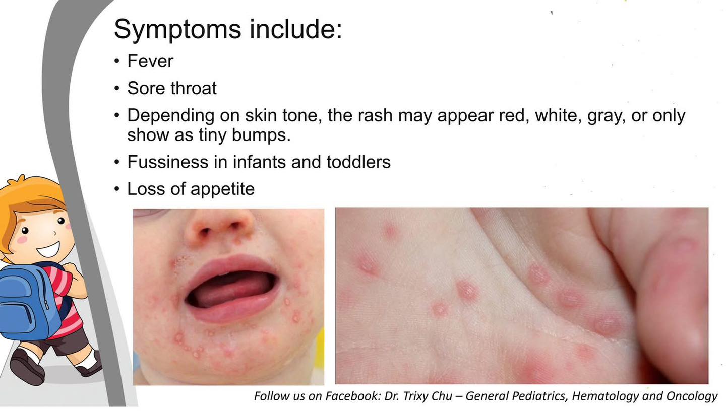 Dr. Trixy Chu - General Pediatrics, Hematology & Oncology | Iloilo City