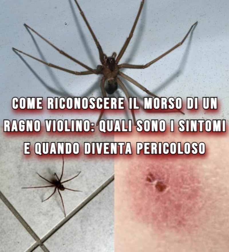 INFORMAZIONE - 🔴 Come riconoscere il morso di un ragno violino: ecco ...