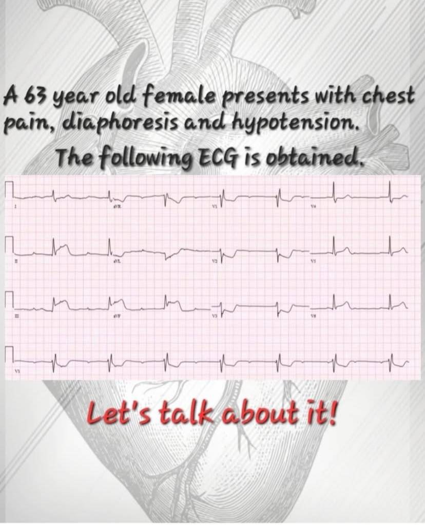 Cardiophilia - 🔴 A 63 year old female presents with chest... | Facebook