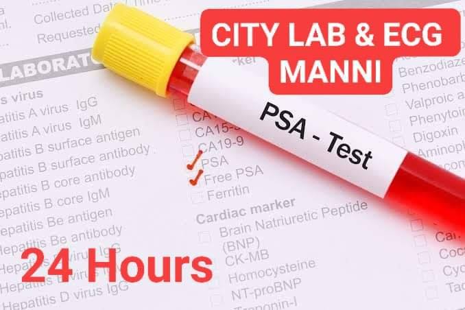 The PSA test is a blood test... - City Lab&Ecg Mannargudi