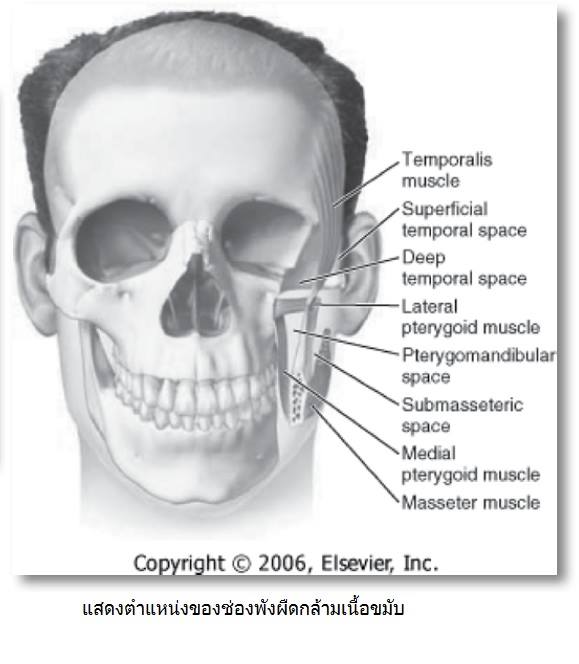 Thaiendodontics - ช่องพังผืดกล้ามเนื้อขมับ (temporal spaces) แบ่งย่อย ...