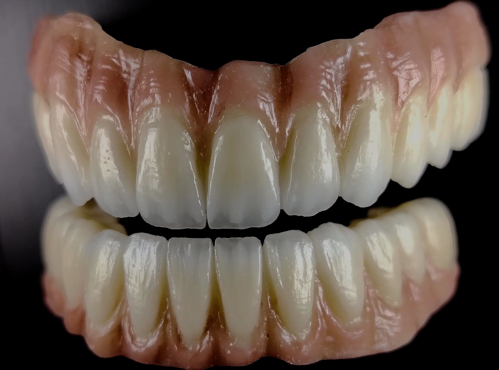 Captek - ️ Captek Dental Lab🔝 Implant case ⤵️ This great image you see ...