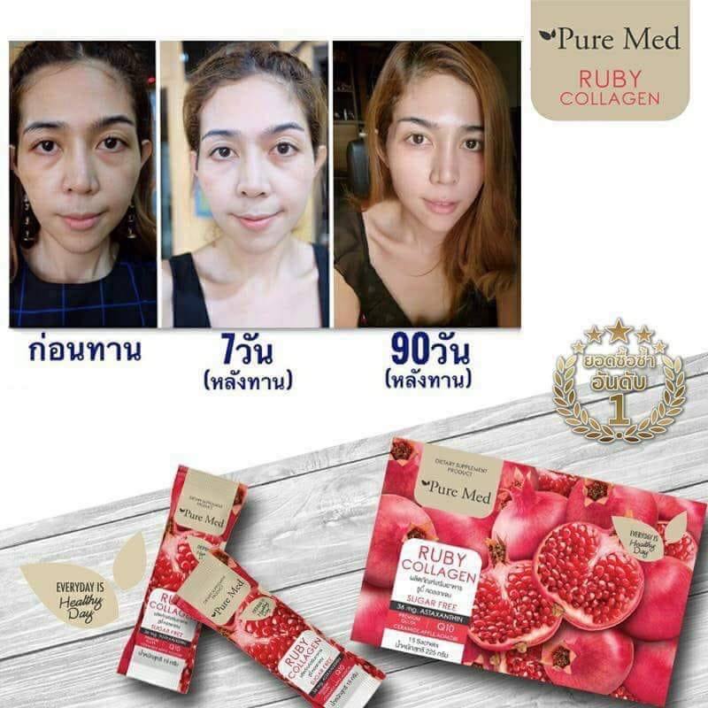 #รูบี้ คอลลาเจน... - อาหารเสริมเติมสวย by ruby collagen