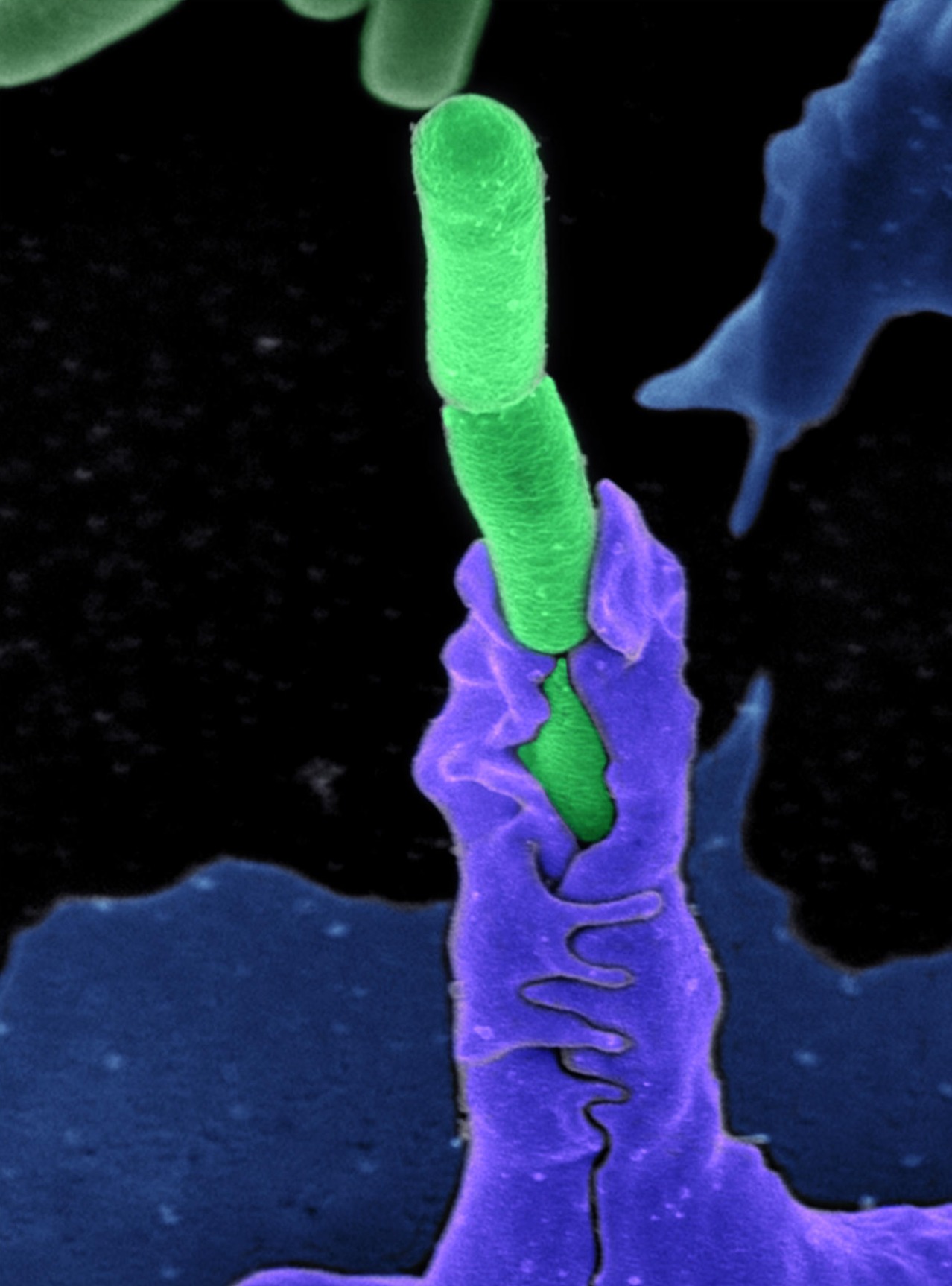 Hashem - An image of an immune cell (purple) eating anthrax bacteria ...