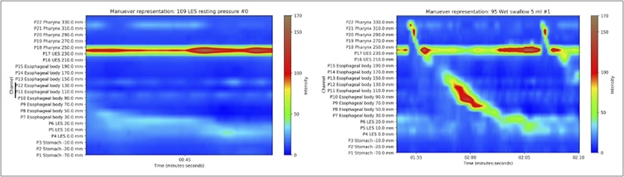 American - Artificial Intelligence Driven Diagnosis of Motility ...