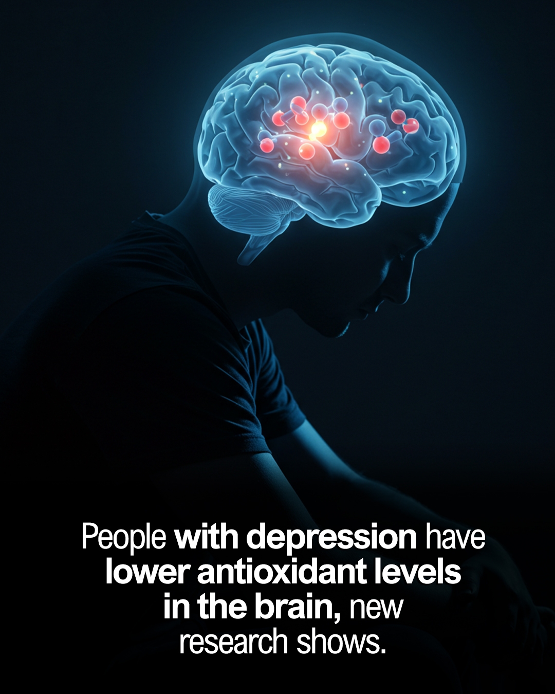 glutathion depression Could be (also) caused by oxidative stress? 🤔 A team of researchers conducted a meta-analysis to explore this. They found that people with depression had lower levels of glutathione—a key antioxidant—in Ferroptosis | Cell death Quantity:15 Patches سيروم تفتيح مخصص