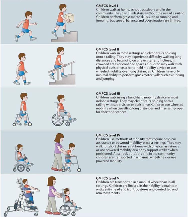 The Gross Motor Function Classification System, 44% OFF