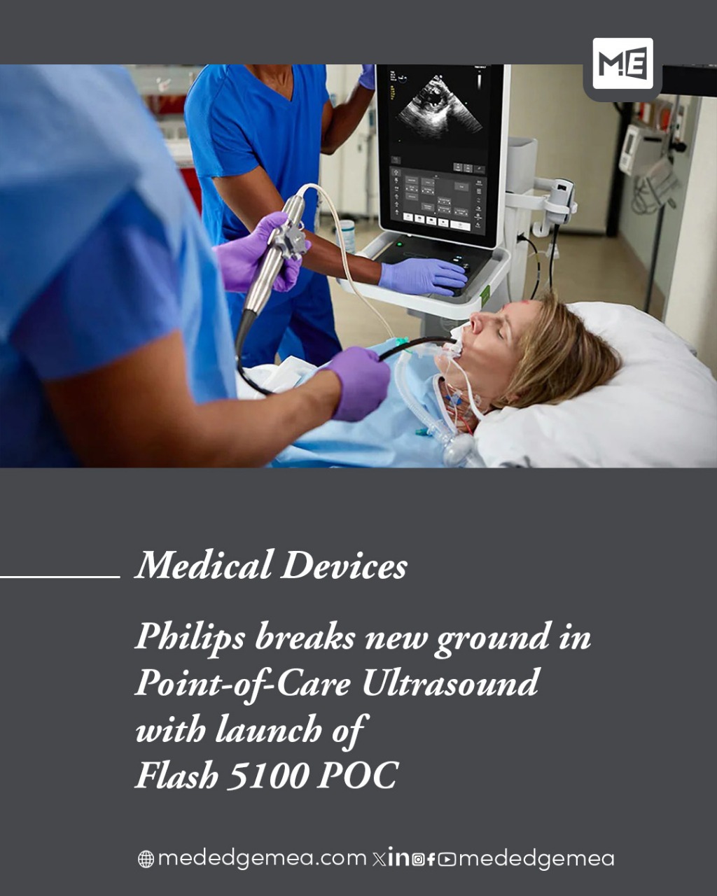 MedEdge - Philips unveils its game-changing point-of-care ultrasound ...