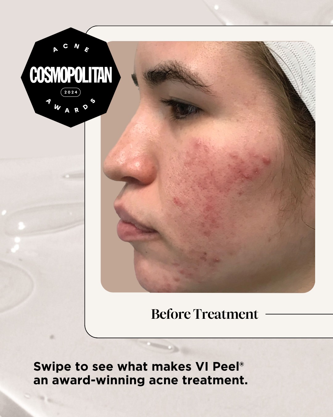 Greenville Dermatology - Whether on the beach, at the pool, or on the ...