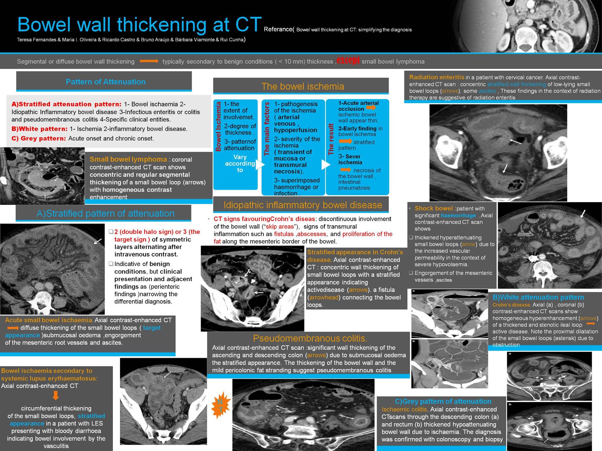 Radiology Albums The Segmental And Diffuse Bowel Wall Thickening Facebook