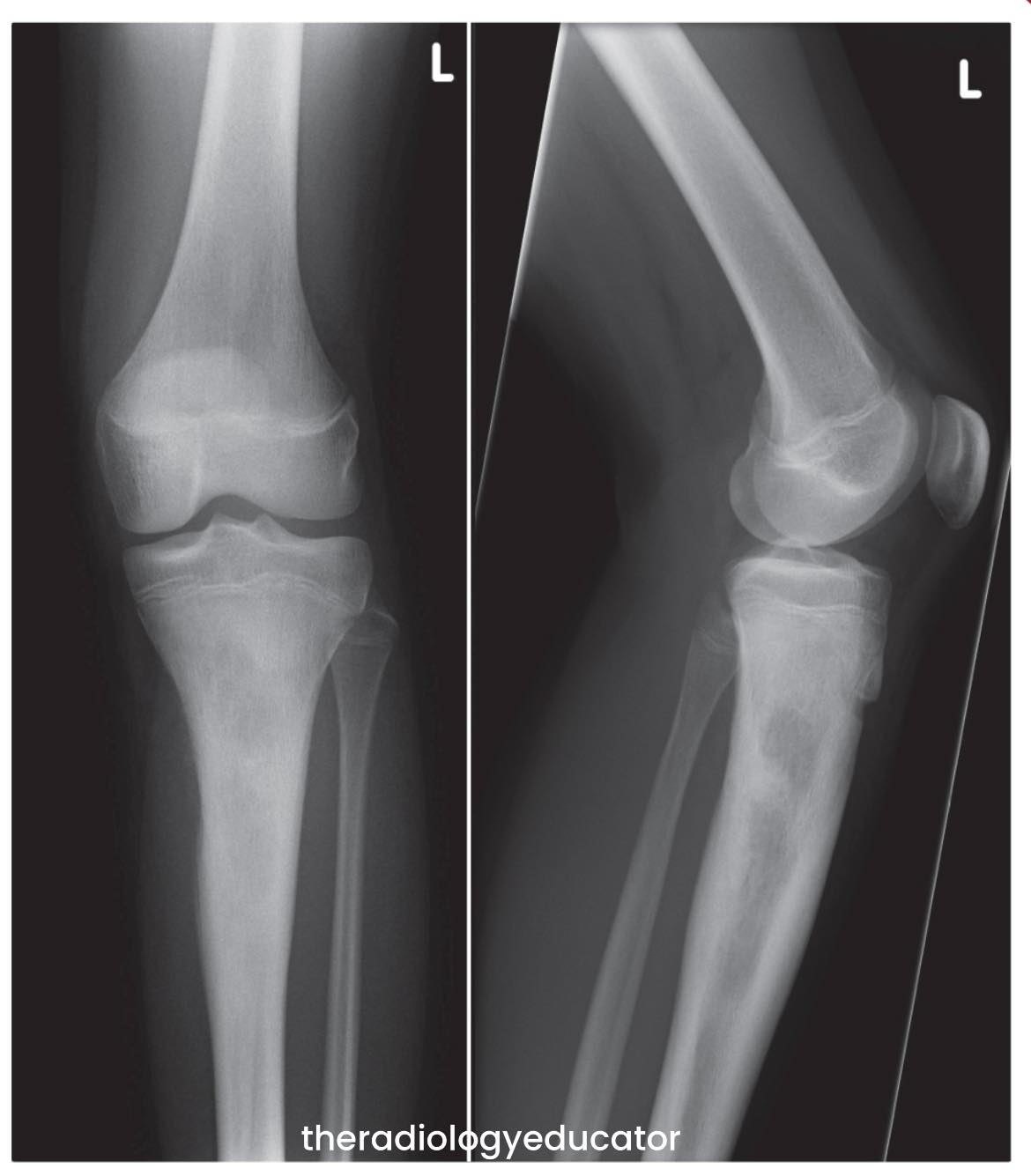The Radiology - A 14 year old boy has presented to A&E following a ...