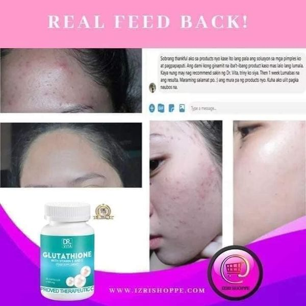 ✨MAGPAPUTl SA MURANG HALAGA ✨BOOST Your Confidence And Achieve Rosy White Glowing SKIN✨ Introducing Enhanced DR VITA GLUTATHIONE with Vitamin C, Vitamin E, Kiwi Extract, Elastin & Probiotics ✓Contains Gluta-Y®