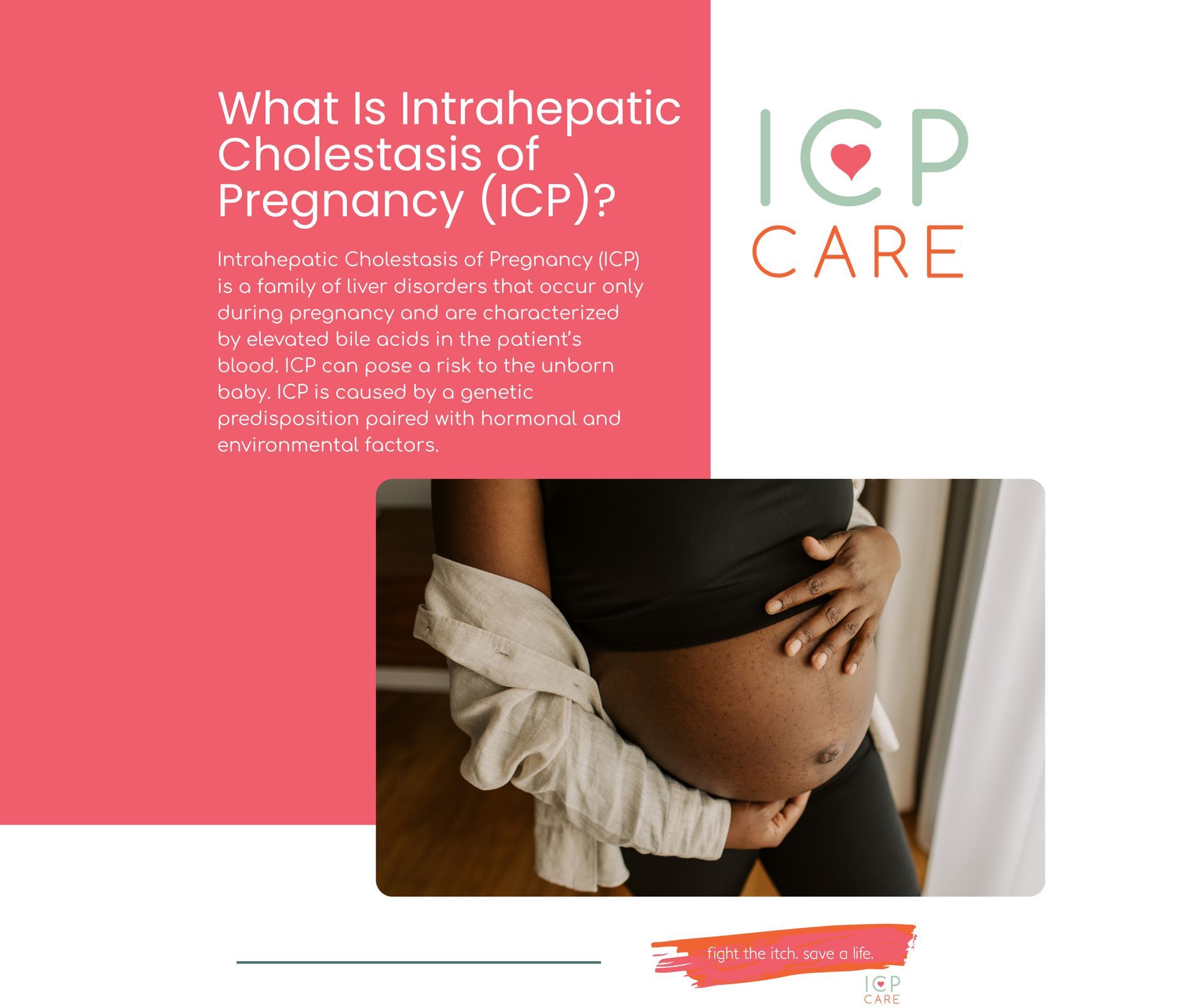 ICP - What is Intrahepatic Cholestasis of Pregnancy (ICP)? ♥️ ICP is a ...