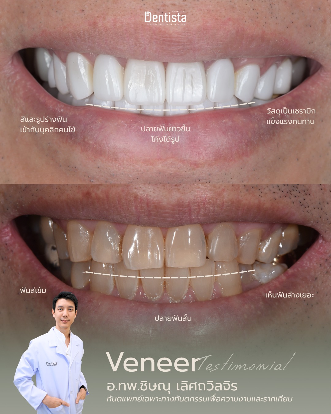 #รีวิวจ... - Dentista Dental Clinic จัดฟัน รากฟันเทียม อ่อนนุช | Facebook