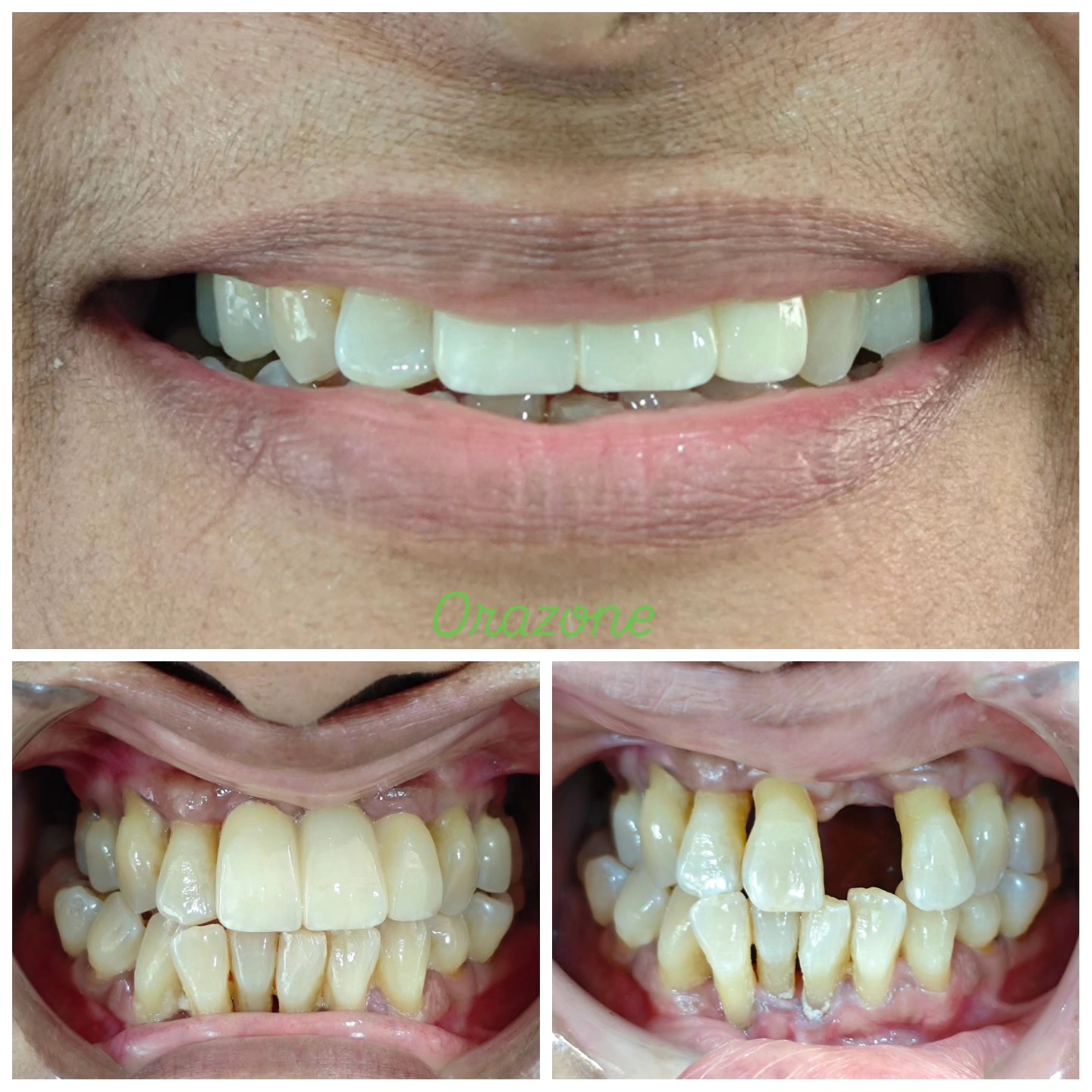 Orazone dental clinic | Vadodara