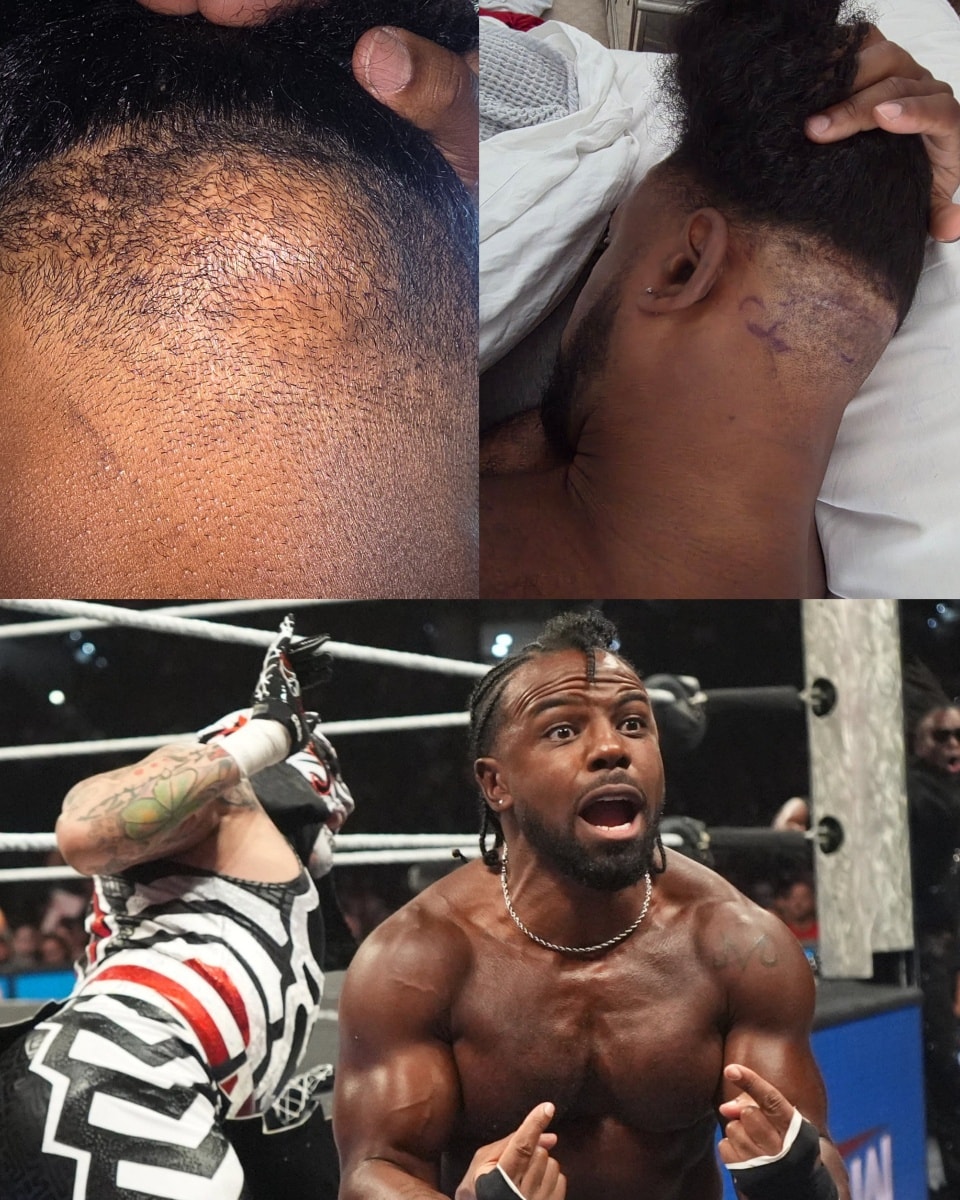 XAVIER WOODS SÍ FUE OPERADO 