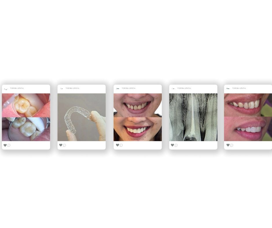 Manuales Dental Clinic - Set Up an Appointment Today! Contact us: 📲 ...