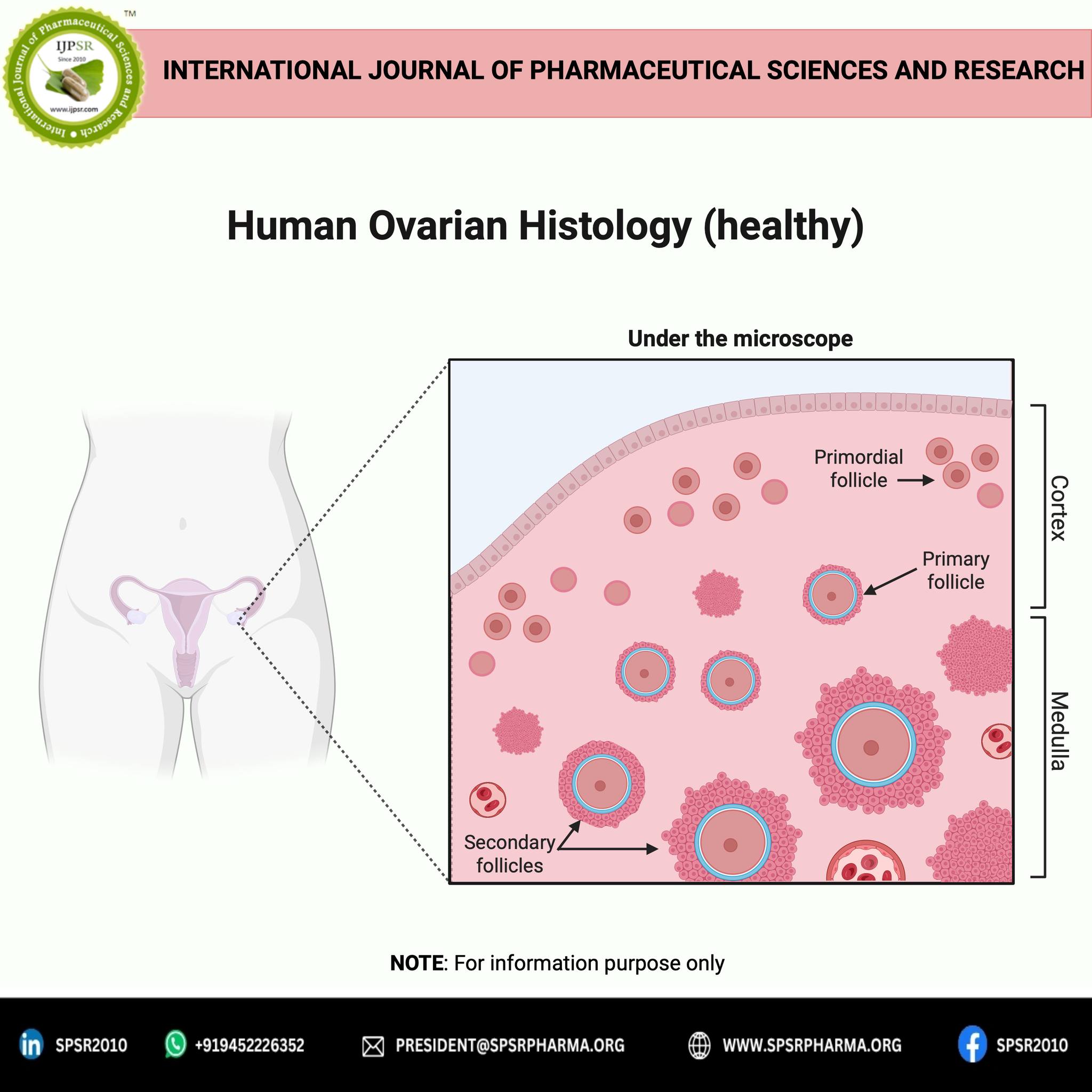 🌸 Polycystic Ovary Syndrome (PCOS): Tackling Insulin Resistance for ...