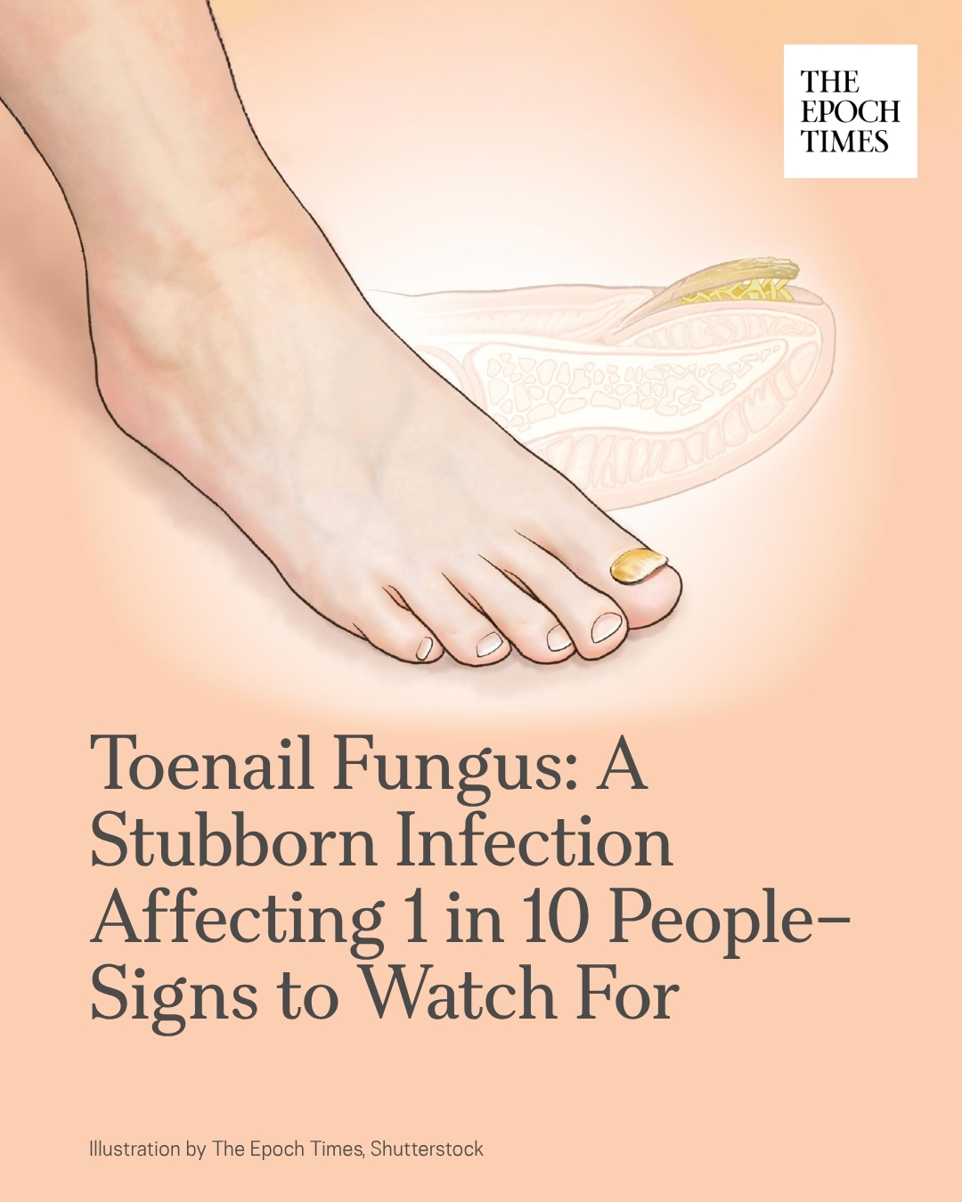 Trending - More than a temporary cosmetic problem, the infection could ...