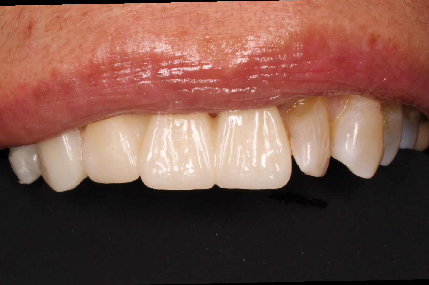 Tree Dent Consultorio Dental | Tuxtla Gutiérrez